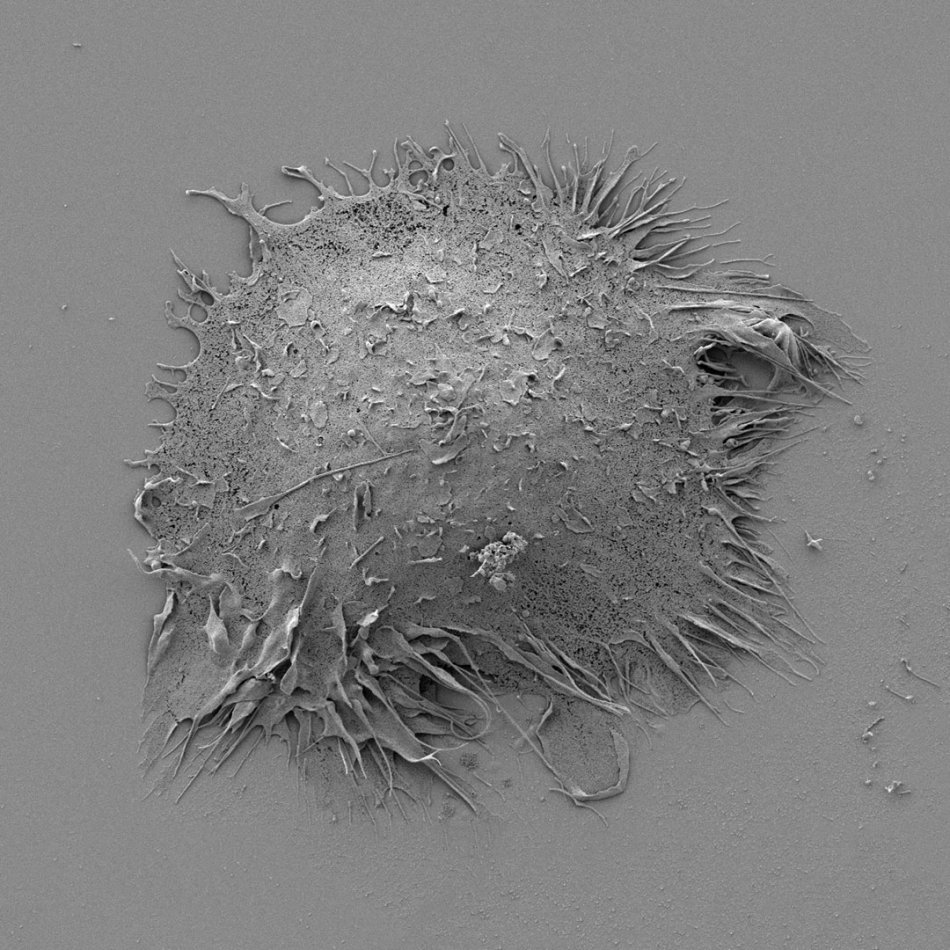 grey cancer-cell